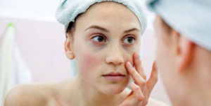 kako do zdrave kože