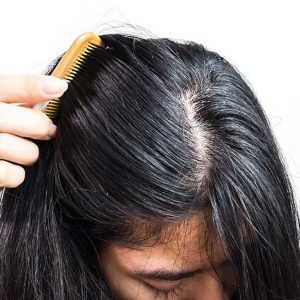 zašto se kosa masti