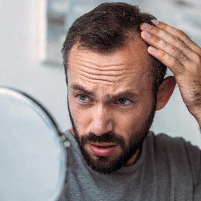 opadanje kose muskarac